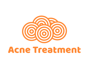 Acne Treatment